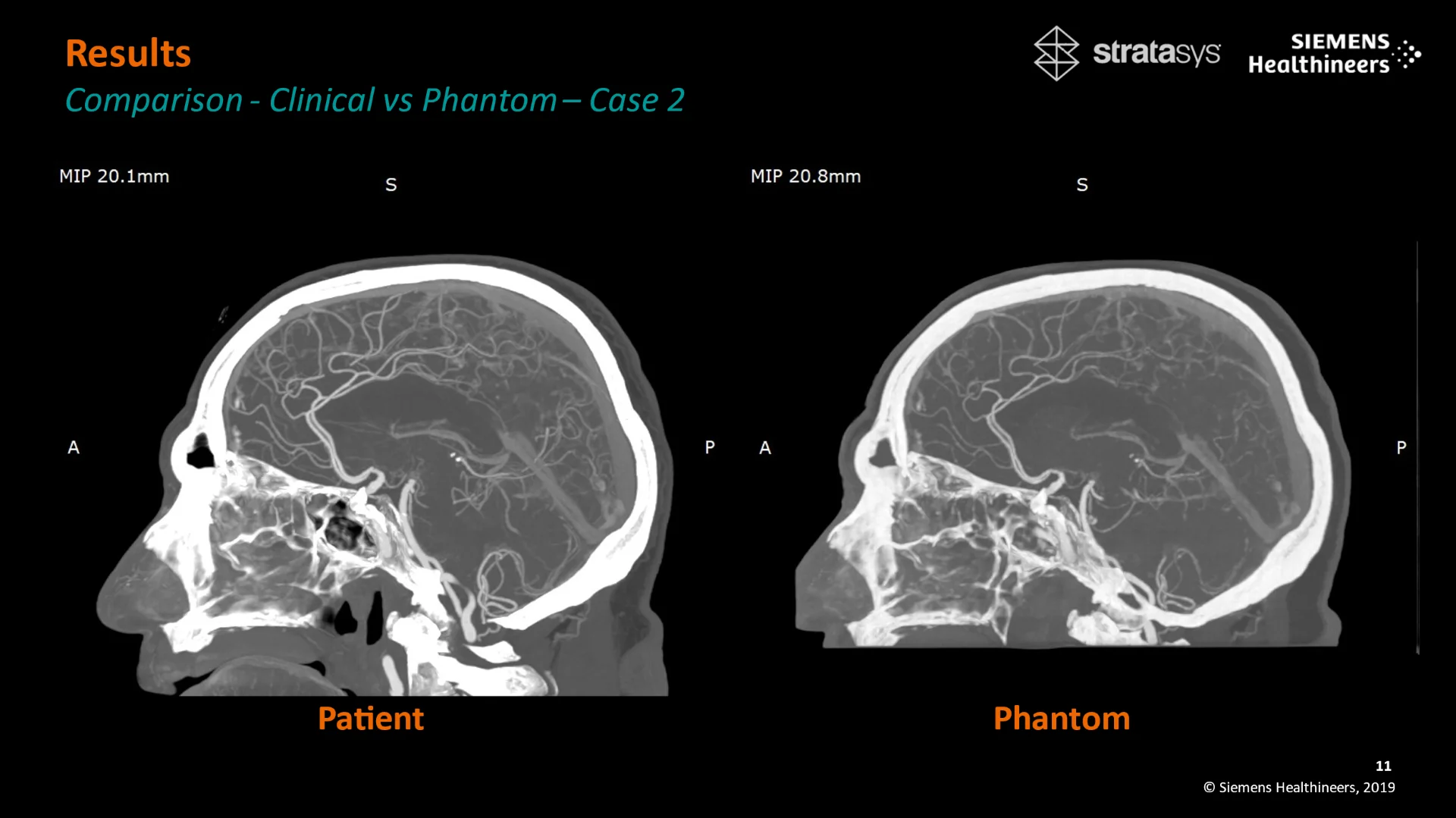 Stratasys and Siemens Healthineers Bring a New Era for Medical Imaging Research With Patient-Specific 3D-Printed Phantoms